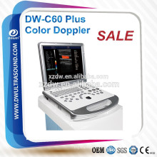 medical equipment DW-C60 Plus DAWEI color doppler ultrasound machine & clear image laptop portable color doppler 3D